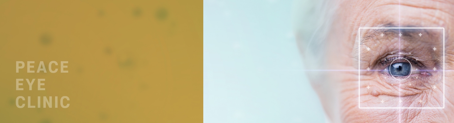 peace eye clinic